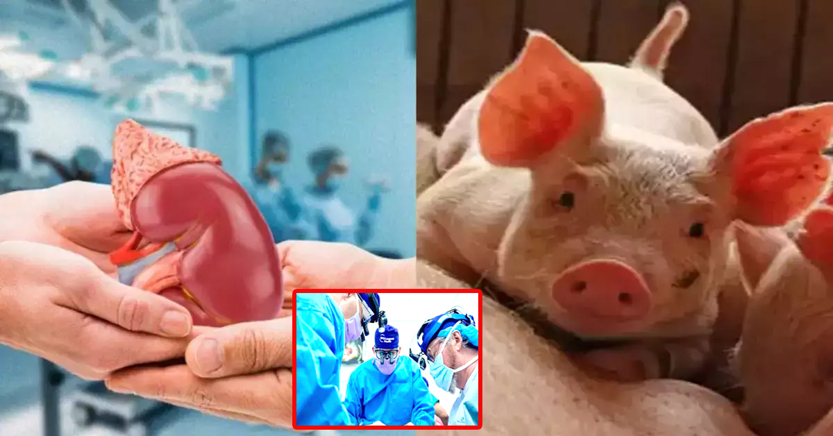 Pig kidney: మనిషికి పంది కిడ్నీ..!