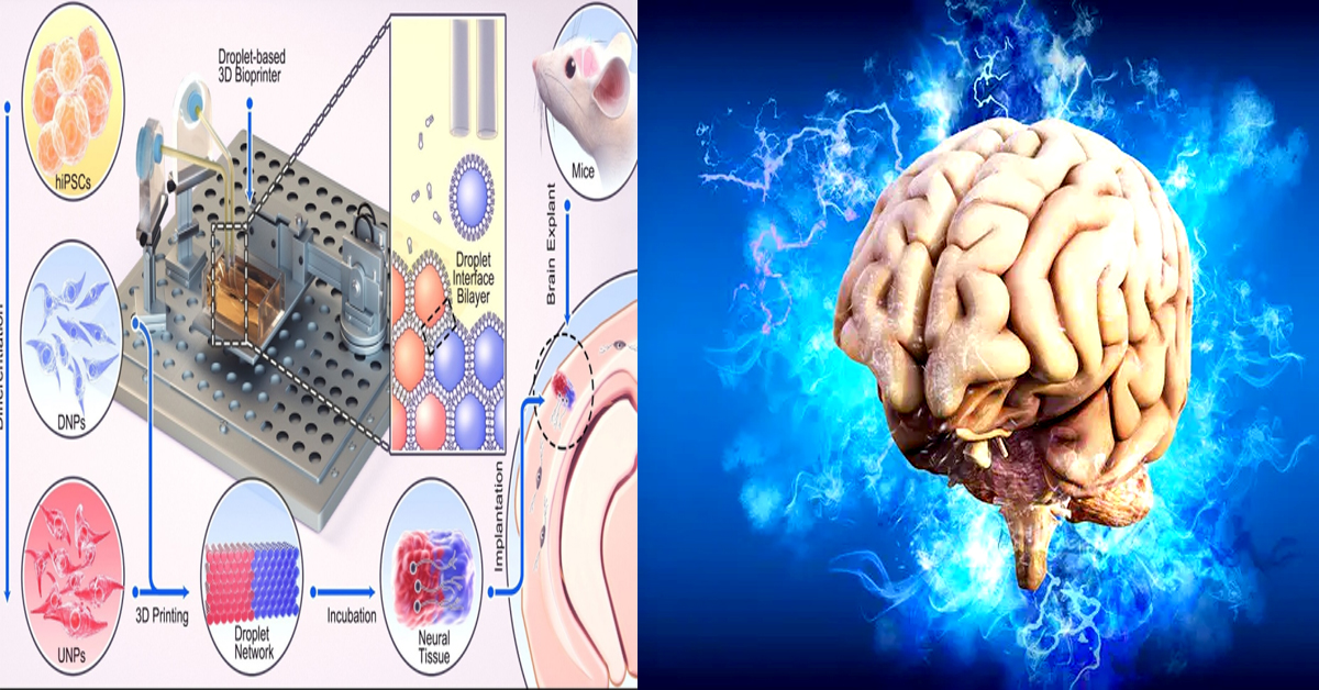 3D treatment for brain : మెదడు గాయాలకు ‘త్రీడీ’ ట్రీట్మెంట్..సైంటిస్టులు కనుగొన్న అద్భుతం!