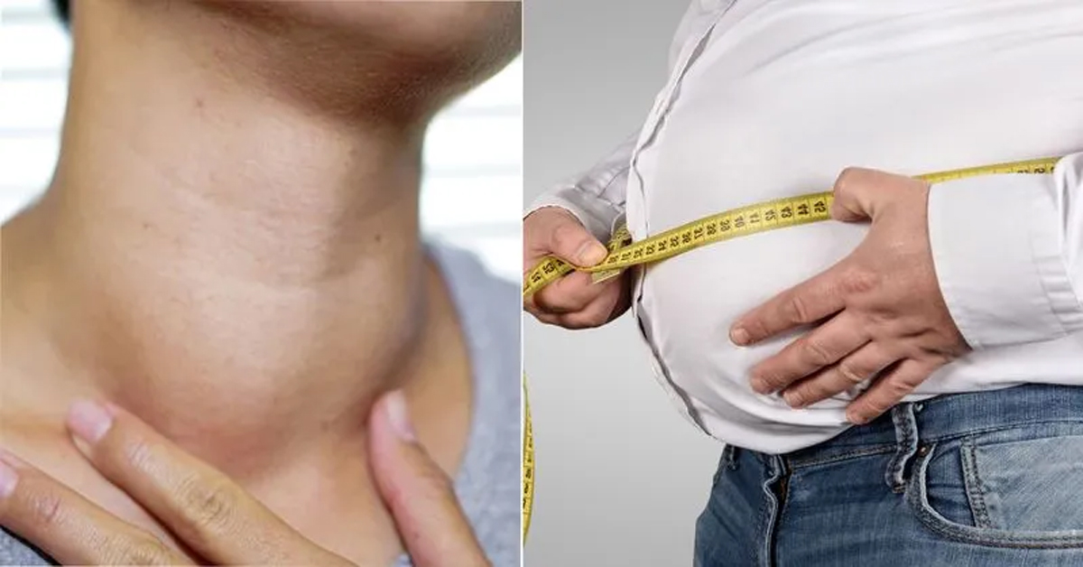 Thyroid: థైరాయిడ్ ఉన్నవారు బరువు తగ్గడానికి చిట్కాలు