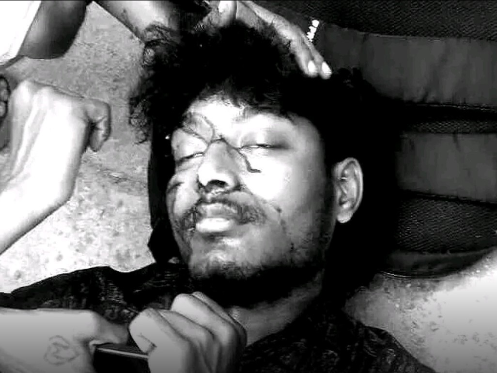 జాతీయ రహదారిపై రోడ్డు ప్రమాదం.. తీవ్ర గాయాలు