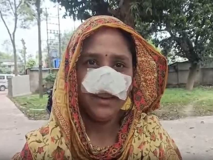 ముక్కు అందంగా ఉందని కొరికేసిన భర్త