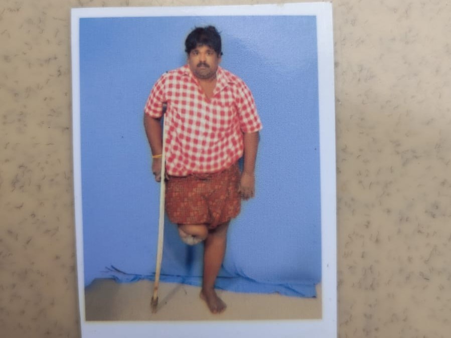 కామవరపుకోటలో లారీ దగ్ధం.. దివ్యాంగుడు మృతి